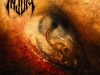 Injury - Parasite